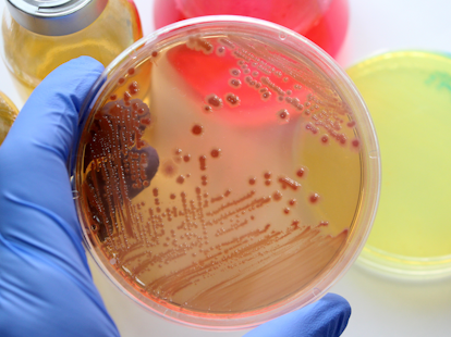 Standardy i certyfikacja podłoży mikrobiologicznych mają wpływ na jakość wyników badań.